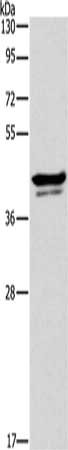 Gel: 10%SDS-PAGE, Lysate: 20 μg, Lane: Human plasma tissue, Primary antibody: APOL1 Antibody(APOL1 Antibody) at dilution 1/300, Secondary antibody: Goat anti rabbit IgG at 1/8000 dilution, Exposure time: 2 secondsRabbit anti-Human APOL1 Polyclonal Antibody