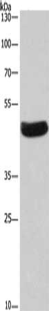 Gel: 8%SDS-PAGE, Lysate: 40 μg, Lane: Hela cells, Primary antibody: SEPT7 Antibody(SEPT7 Antibody) at dilution 1/380, Secondary antibody: Goat anti rabbit IgG at 1/8000 dilution, Exposure time: 30 secondsRabbit anti-Human SEPT7 Polyclonal Antibody