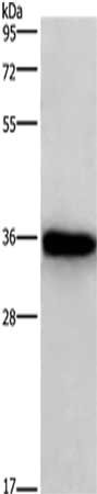 Gel: 10%SDS-PAGE, Lysate: 40 μg, Lane: Human normal liver tissue, Primary antibody: MARC1 Antibody(MARC1 Antibody) at dilution 1/350, Secondary antibody: Goat anti rabbit IgG at 1/8000 dilution, Exposure time: 5 minutes