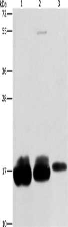 Gel: 12%SDS-PAGE, Lysate: 40 μg, Lane 1-3: Hela cells, hepg2 cells, A375 cells, Primary antibody: IFITM3 Antibody(IFITM3 Antibody) at dilution 1/500, Secondary antibody: Goat anti rabbit IgG at 1/8000 dilution, Exposure time: 10 secondsRabbit anti-Human IFITM3 Polyclonal Antibody