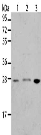 Gel: 12%SDS-PAGE, Lysate: 40 μg, Lane 1-3: Jurkat cells, A172 cells, human liver cancer tissue, Primary antibody: BNIP1 Antibody(BNIP1 Antibody) at dilution 1/275, Secondary antibody: Goat anti rabbit IgG at 1/8000 dilution, Exposure time: 10 seconds