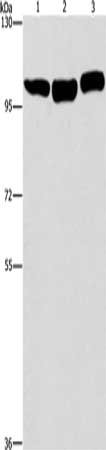Gel: 6%SDS-PAGE, Lysate: 40 μg, Lane 1-3: Hela cells, NIH/3T3 cells, Raji cells, Primary antibody: DNM2 Antibody(DNM2 Antibody) at dilution 1/400, Secondary antibody: Goat anti rabbit IgG at 1/8000 dilution, Exposure time: 30 secondsRabbit anti-Human DNM2 Polyclonal Antibody