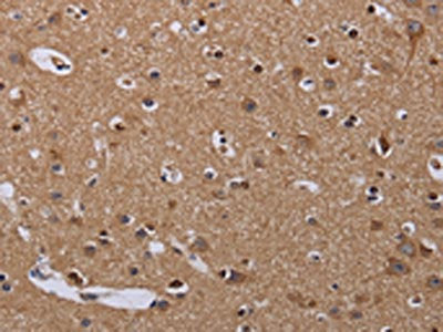 The image on the left is immunohistochemistry of paraffin-embedded Human brain  tissue using MCTS1 Antibody(MCTS1 Antibody) at dilution 1/60, on the right is treated with fusion protein. (Original magnification: ×200)