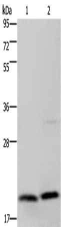 Gel: 10%SDS-PAGE, Lysate: 40 μg, Lane 1-2: Jurkat cells, PC3 cells, Primary antibody: MCTS1 Antibody(MCTS1 Antibody) at dilution 1/200, Secondary antibody: Goat anti rabbit IgG at 1/8000 dilution, Exposure time: 1 minute