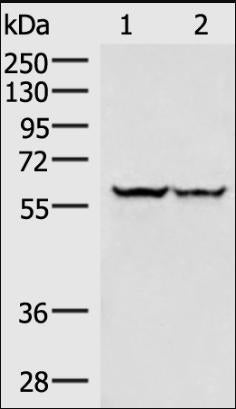 Gel: 8%SDS-PAGE, Lysate: 30 μg, Lane 1-2: Hela cells, 293T cells, Primary antibody: VIM Antibody(VIM Antibody) at dilution 1/250, Secondary antibody: Goat anti rabbit IgG at 1/8000 dilution, Exposure time: 30 secondsRabbit anti-Human VIM Polyclonal Antibody