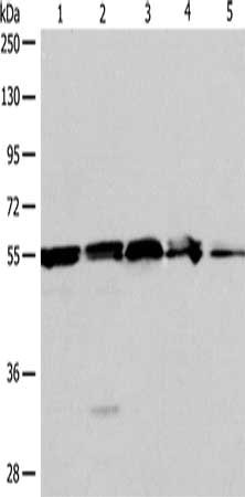 Gel: 10%SDS-PAGE, Lysate: 40 μg, Lane 1-5: A375 cells, 293T cells, mouse liver tissue, Jurkat cells, human fetal kidney tissue, Primary antibody: NAMPT Antibody(NAMPT Antibody) at dilution 1/700, Secondary antibody: Goat anti rabbit IgG at 1/8000 dilution, Exposure time: 1 minuteRabbit anti-Human NAMPT Polyclonal Antibody