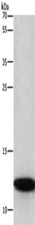 Gel: 10%SDS-PAGE, Lysate: 40 μg, Lane: A172 cells, Primary antibody: BRK1 Antibody(BRK1 Antibody) at dilution 1/350, Secondary antibody: Goat anti rabbit IgG at 1/8000 dilution, Exposure time: 1 minute