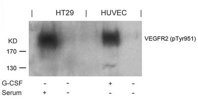 Western blot analysis of extracts from G-CSF-treated HUVEC and serum-treated HT29 cells using VEGFR2(Phospho-Tyr951) Antibody.