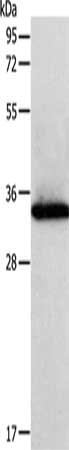 Gel: 12%SDS-PAGE, Lysate: 40 μg, Lane: MCF-7 cells, Primary antibody: SIRT4 Antibody(SIRT4 Antibody) at dilution 1/450, Secondary antibody: Goat anti rabbit IgG at 1/8000 dilution, Exposure time: 1 minuteRabbit anti-Human SIRT4 Polyclonal Antibody