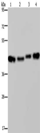 Gel: 8%SDS-PAGE, Lysate: 40 μg, Lane 1-4: HepG2 cells, Raji cells, A431 cells, 231 cells, Primary antibody: DNAJA1 Antibody(DNAJA1 Antibody) at dilution 1/800, Secondary antibody: Goat anti rabbit IgG at 1/8000 dilution, Exposure time: 5 secondsRabbit anti-Human DNAJA1 Polyclonal Antibody