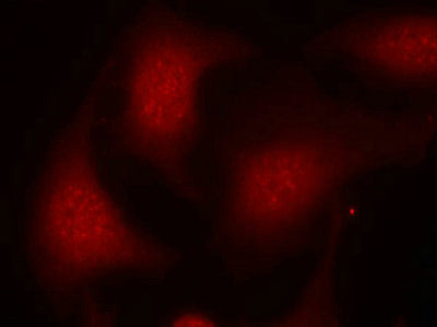 Immunofluorescence staining of methanol-fixed Hela cells using Rb(Phospho-Ser795) Antibody.Rabbit anti-Human RB1 Polyclonal Antibody