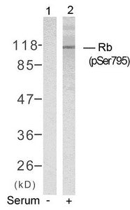 Western blot analysis of extracts from K562 cells untreated(lane 1) or treated with serum(lane 2) using Rb(Phospho-Ser795) Antibody.Rabbit anti-Human RB1 Polyclonal Antibody