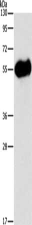 Gel: 15%SDS-PAGE, Lysate: 40 μg, Lane: Mouse pancreas tissue, Primary antibody: AMY2A Antibody(AMY2A Antibody) at dilution 1/1400, Secondary antibody: Goat anti rabbit IgG at 1/8000 dilution, Exposure time: 1 secondRabbit anti-Human AMY2A Polyclonal Antibody