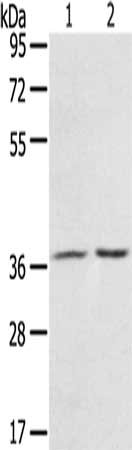 Gel: 8%SDS-PAGE, Lysate: 40 μg, Lane 1-2: Mouse stomach tissue, A431 cells, Primary antibody: PDLIM4 Antibody(PDLIM4 Antibody) at dilution 1/800, Secondary antibody: Goat anti rabbit IgG at 1/8000 dilution, Exposure time: 3 secondsRabbit anti-Human PDLIM4 Polyclonal Antibody