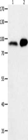 Gel: 8%SDS-PAGE, Lysate: 40 μg, Lane 1-2: Human brain malignant glioma tissue, mouse brain tissue, Primary antibody: HCN1 Antibody(HCN1 Antibody) at dilution 1/1500, Secondary antibody: Goat anti rabbit IgG at 1/8000 dilution, Exposure time: 2 minutesRabbit anti-Human HCN1 Polyclonal Antibody