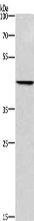 Gel: 8%SDS-PAGE, Lysate: 40 μg, Lane: Hela cells, Primary antibody: BGN Antibody(BGN Antibody) at dilution 1/550, Secondary antibody: Goat anti rabbit IgG at 1/8000 dilution, Exposure time: 30 seconds