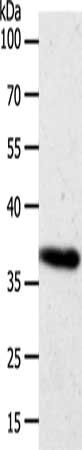 Gel: 10%SDS-PAGE, Lysate: 27 μg, Lane: Hela cells, Primary antibody: AKR1B1 Antibody(AKR1B1 Antibody) at dilution 1/700, Secondary antibody: Goat anti rabbit IgG at 1/8000 dilution, Exposure time: 4 secondsRabbit anti-Human AKR1B1 Polyclonal Antibody