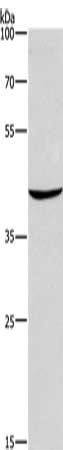 Gel: 8%SDS-PAGE, Lysate: 40μg, Lane: Mouse skin tissue, Primary antibody: CD207 Antibody(CD207 Antibody) at dilution 1/425, Secondary antibody: Goat anti rabbit IgG at 1/8000 dilution, Exposure time: 30 secondsRabbit anti-Human CD207 Polyclonal Antibody