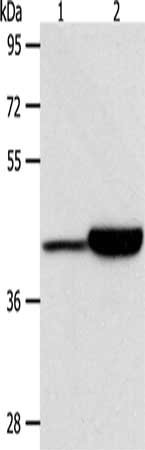 Gel: 10%SDS-PAGE, Lysate: 40 μg, Lane 1-2: Jurkat cells, RAW264.7 cells, Primary antibody: CAPG Antibody(CAPG Antibody) at dilution 1/950, Secondary antibody: Goat anti rabbit IgG at 1/8000 dilution, Exposure time: 20 seconds