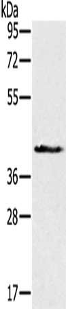 Gel: 8%SDS-PAGE, Lysate: 60 μg, Lane: Human fetal muscle tissue, Primary antibody: NDUFA9 Antibody(NDUFA9 Antibody) at dilution 1/300, Secondary antibody: Goat anti rabbit IgG at 1/8000 dilution, Exposure time: 10 secondsRabbit anti-Human NDUFA9 Polyclonal Antibody