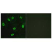 Immunofluorescence analysis of HeLa cells, using TBX15/18 antibody.Rabbit anti-Human TBX15/TBX18 Polyclonal Antibody