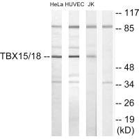 Western blot analysis of extracts from HeLa cells, HUVEC cells and Jurkat cells, using TBX15/18 antibody.Rabbit anti-Human TBX15/TBX18 Polyclonal Antibody