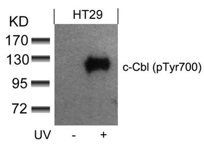 Western blot analysis of extracts from HT29 cells untreated or treated with UV using c-Cbl(phospho-Tyr700) Antibody.