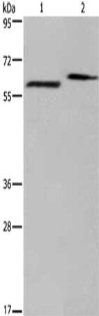 Gel: 6%SDS-PAGE,Lysate: 40 μg,Lane 1-2: Human fetal brain tissue, Mouse brain tissue,Primary antibody: EGR4 Antibody(EGR4 Antibody) at dilution 1/400 dilution,Secondary antibody: Goat anti rabbit IgG at 1/8000 dilution,Exposure time: 2 minutesRabbit anti-Human EGR4 Polyclonal Antibody