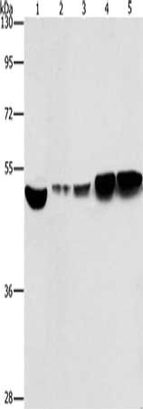 Gel: 8%SDS-PAGE, Lysate: 40 μg, Lane 1-5: Hela cells, A431 cells, mouse brain tissue, Mouse liver tissue, mouse pancreas tissue, Primary antibody: ENO1 Antibody(ENO1 Antibody) at dilution 1/500, Secondary antibody: Goat anti rabbit IgG at 1/8000 dilution, Exposure time: 10 secondsRabbit anti-Human ENO1 Polyclonal Antibody