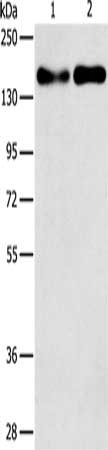 Gel: 8%SDS-PAGE, Lysate: 40 μg, Lane 1-2: A431 cells, Huvec cells, Primary antibody: THBS1 Antibody(THBS1 Antibody) at dilution 1/250, Secondary antibody: Goat anti rabbit IgG at 1/8000 dilution, Exposure time: 5 minutesRabbit anti-Human THBS1 Polyclonal Antibody