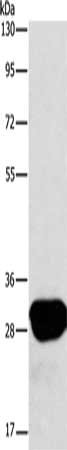 Gel: 10%SDS-PAGE, Lysate: 40 μg, Lane: A549 cells, Primary antibody: LXN Antibody(LXN Antibody) at dilution 1/667, Secondary antibody: Goat anti rabbit IgG at 1/8000 dilution, Exposure time: 10 seconds
