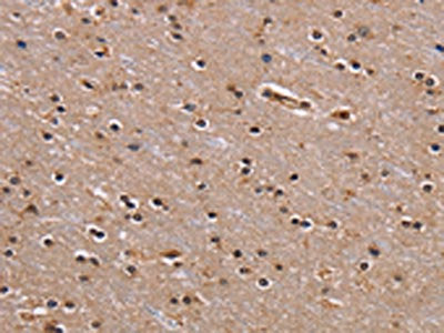 The image on the left is immunohistochemistry of paraffin-embedded Human brain tissue using the antibody Antibody) at dilution 1/60, on the right is treated with fusion protein. (Original magnification: ×200)Rabbit anti-Human GNL3 Polyclonal Antibody