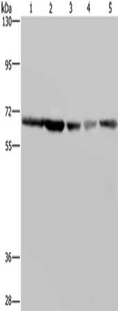 Gel: 6%SDS-PAGE, Lysate: 40 μg, Lane 1-5: K562 cells, Hela cells, LoVo cells, 293T cells, Raji cells, Primary antibody: GNL3 Antibody(GNL3 Antibody) at dilution 1/300, Secondary antibody: Goat anti rabbit IgG at 1/8000 dilution, Exposure time: 5 secondsRabbit anti-Human GNL3 Polyclonal Antibody