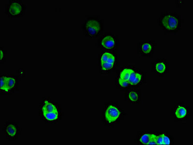 Immunofluorescent analysis of MCF-7 cells using SRGAP2B Antibody at dilution of 1:100 and Alexa Fluor 488-congugated AffiniPure Goat Anti-Rabbit IgG(H+L)Rabbit anti-Human SRGAP2B Polyclonal Antibody