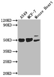 Western Blot | Positive WB detected in: A549 whole cell lysate, MCF-7 whole cell lysate, Mouse Heart tissue | All lanes: SRGAP2B antibody at 1:2000 | Secondary | Goat polyclonal to rabbit IgG at 1/50000 dilution | Predicted band size: 54 kDa | Observed band size: 54 kDaRabbit anti-Human SRGAP2B Polyclonal Antibody