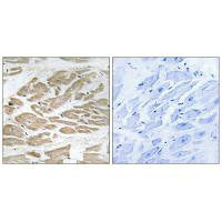 Immunohistochemistry analysis of paraffin-embedded human heart tissue using BRP44L antibody.Rabbit anti-Human MPC1 Polyclonal Antibody