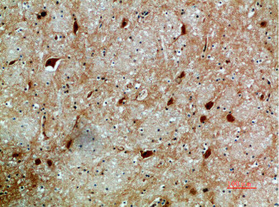 Immunohistochemical analysis of paraffin-embedded human-brain, antibody was diluted at 1:200Rabbit anti-Human NFAT5 Polyclonal Antibody