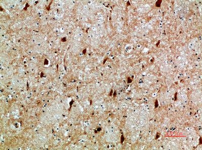 Immunohistochemical analysis of paraffin-embedded human-brain, antibody was diluted at 1:200Rabbit anti-Human NFAT5 Polyclonal Antibody