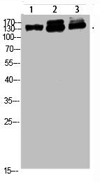 Western blot analysis of 823 293T-UV HELA Cell Lysate, antibody was diluted at 1:1000Rabbit anti-Human NFAT5 Polyclonal Antibody