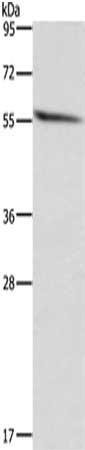 Gel: 8%SDS-PAGE, Lysate: 40 μg, Lane: Human fetal brain tissue, Primary antibody: ACVR2B Antibody(ACVR2B Antibody) at dilution 1/300, Secondary antibody: Goat anti rabbit IgG at 1/8000 dilution, Exposure time: 20 secondsRabbit anti-Human ACVR2B Polyclonal Antibody