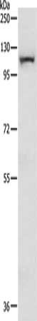 Gel: 8%SDS-PAGE, Lysate: 40 μg, Lane: Mouse lung tissue, Primary antibody: MAP3K14 Antibody(MAP3K14 Antibody) at dilution 1/200, Secondary antibody: Goat anti rabbit IgG at 1/8000 dilution, Exposure time: 10 minutes
