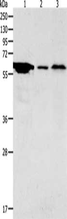 Gel: 10%SDS-PAGE, Lysate: 40 μg, Lane 1-3: Hela cells, Mouse stomach tissue, Mouse brain tissue, Primary antibody: ADCYAP1R1 Antibody(ADCYAP1R1 Antibody) at dilution 1/2000, Secondary antibody: Goat anti rabbit IgG at 1/8000 dilution, Exposure time: 5 minutesRabbit anti-Human ADCYAP1R1 Polyclonal Antibody