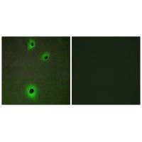 Immunofluorescence analysis of A549 cells, using CADM4 antibody.
