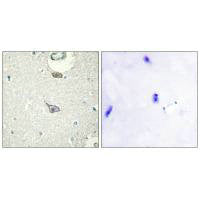 Immunohistochemistry analysis of paraffin-embedded human brain tissue using CADM4 antibody.