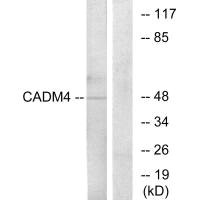 Western blot analysis of extracts from RAW264.7 cells, using CADM4 antibody.