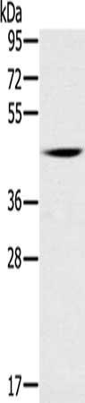 Gel: 8%SDS-PAGE, Lysate: 40 μg, Lane: Mouse brain tissue, Primary antibody: DUSP10 Antibody(DUSP10 Antibody) at dilution 1/200, Secondary antibody: Goat anti rabbit IgG at 1/8000 dilution, Exposure time: 5 minutesRabbit anti-Human DUSP10 Polyclonal Antibody