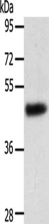 Gel: 10%SDS-PAGE, Lysate: 40 μg, Lane: Human liver cancer tissue, Primary antibody: SPATA17 Antibody(SPATA17 Antibody) at dilution 1/400, Secondary antibody: Goat anti rabbit IgG at 1/8000 dilution, Exposure time: 1 minuteRabbit anti-Human SPATA17 Polyclonal Antibody