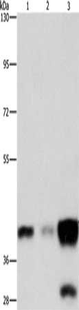 Gel: 8%SDS-PAGE, Lysate: 40 μg, Lane 1-3: Human colon cancer tissue, human fetal brain tissue, Human fetal lung tissue, Primary antibody: ASAH1 Antibody(ASAH1 Antibody) at dilution 1/800, Secondary antibody: Goat anti rabbit IgG at 1/8000 dilution, Exposure time: 30 secondsRabbit anti-Human ASAH1 Polyclonal Antibody