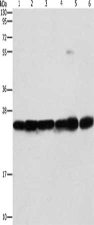 Gel: 10%SDS-PAGE, Lysate: 40 μg, Lane 1-6: Mouse liver tissue, Mouse brain tissue, 293T cells, A549 cells, A431 cells, PC3 cells, Primary antibody: SIGMAR1 Antibody(SIGMAR1 Antibody) at dilution 1/310, Secondary antibody: Goat anti rabbit IgG at 1/8000 dilution, Exposure time: 1 secondRabbit anti-Human SIGMAR1 Polyclonal Antibody