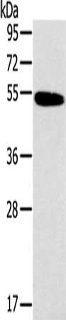 Gel: 8%SDS-PAGE, Lysate: 40 μg, Lane: Human normal colon tissue, Primary antibody: HRH1 Antibody(HRH1 Antibody) at dilution 1/200, Secondary antibody: Goat anti rabbit IgG at 1/8000 dilution, Exposure time: 2 minutesRabbit anti-Human HRH1 Polyclonal Antibody